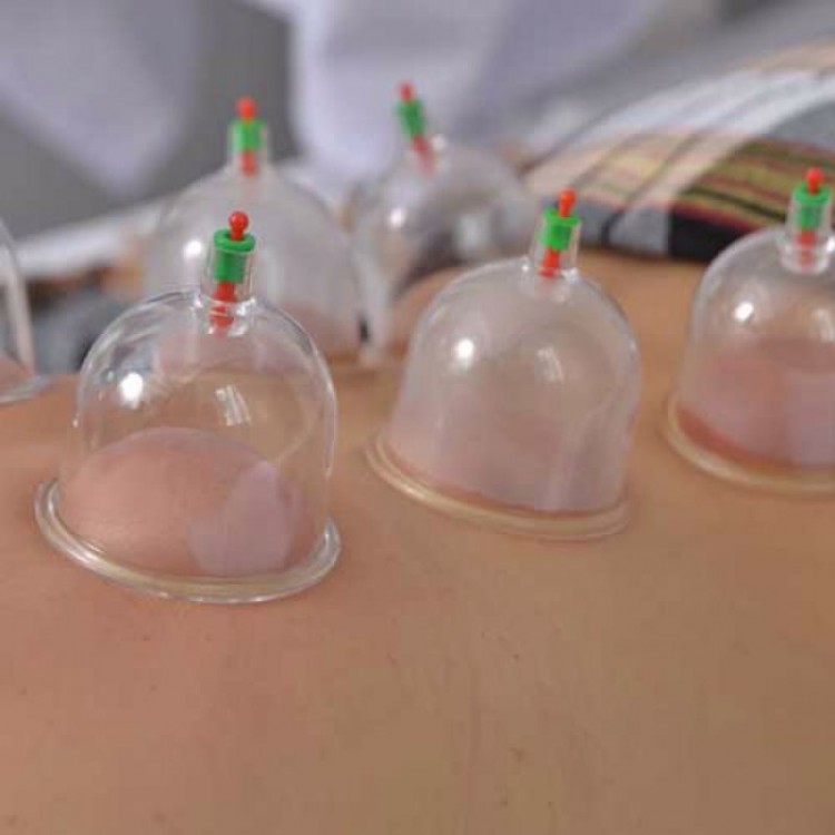 12 Parça Vakumlu Hacamat Kupa Çekme Seti 12 Parça Vakumlu Hacamat Kupa Çekme Seti